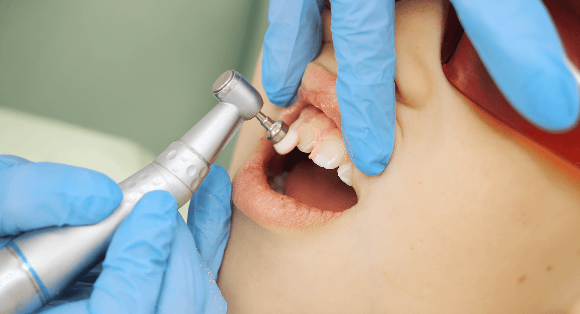 Как проходит процедура