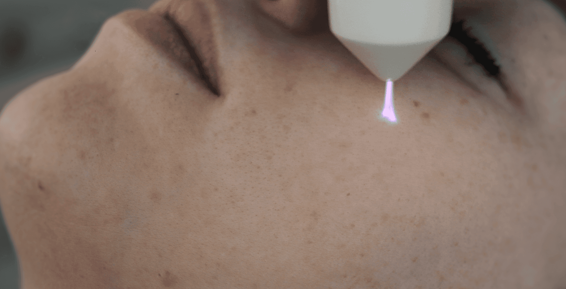 Как проходит процедура